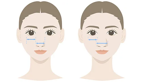 ⑦小鼻の大きさは…